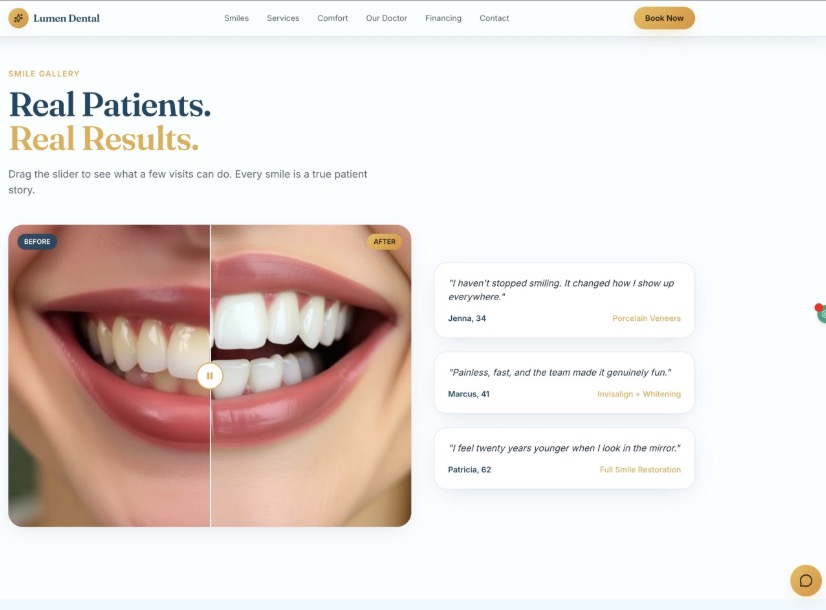 Dentist Elite smile gallery with a before-and-after comparison slider and patient stories
